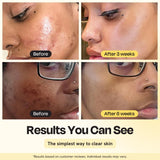 Jumbo Vitamin C Clay Mask